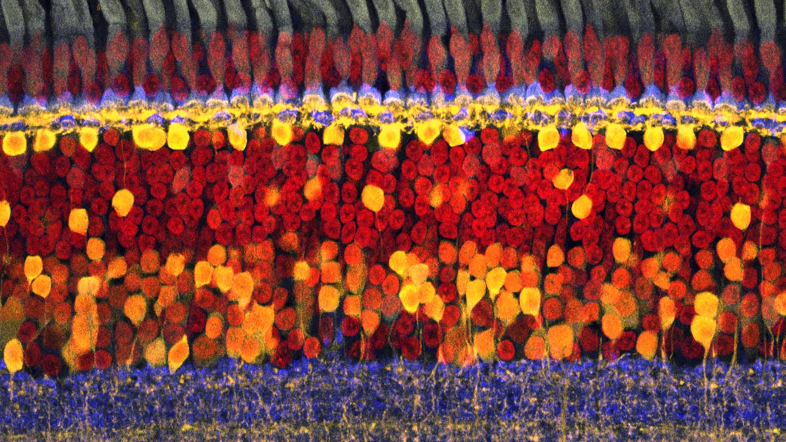 Fluorescence imaging of the retina