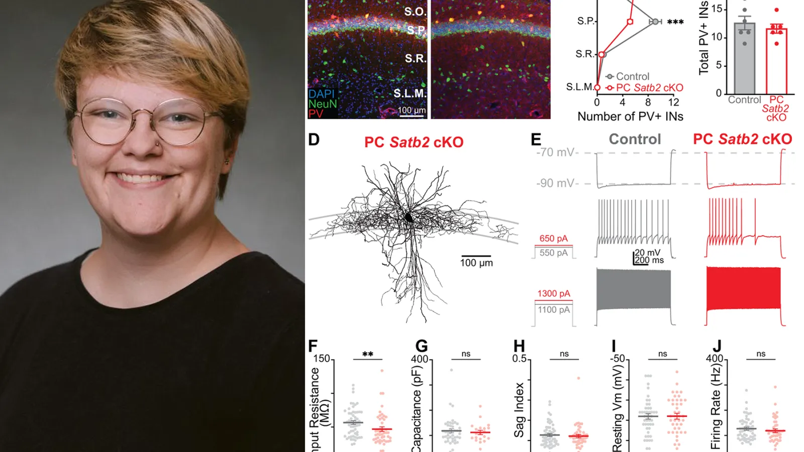 Meretta Hanson Journal of Neuroscience 2025