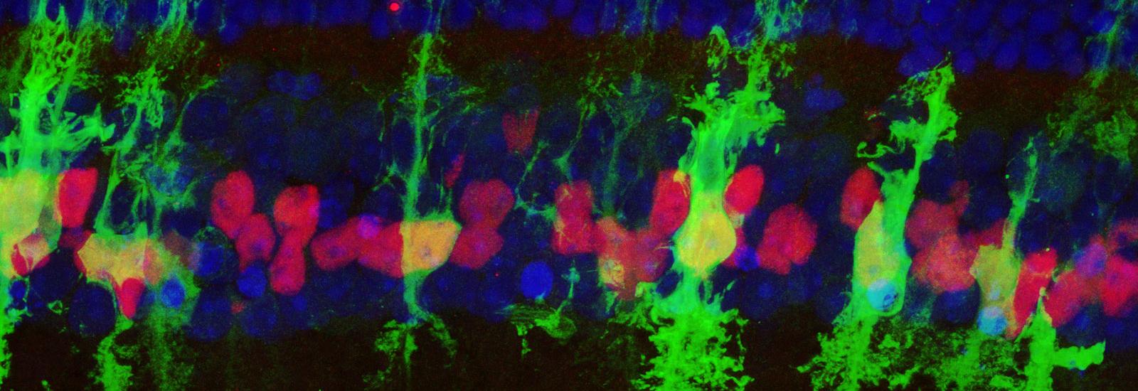 Ascl1-over expressing MG in the mouse retina