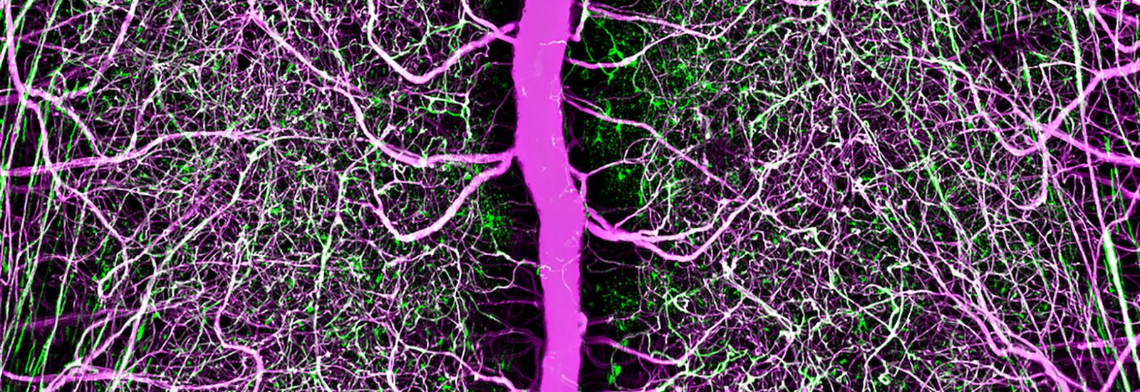 Fluorescent imaging of vasculature