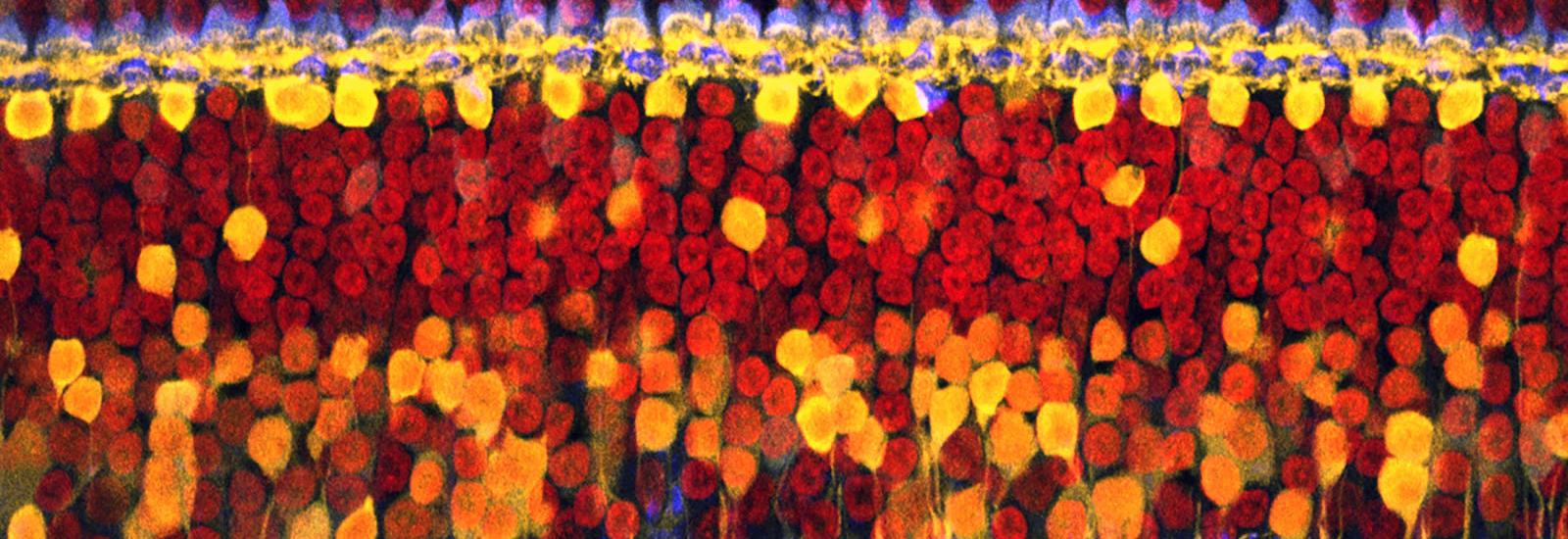 Fluorescence imaging of the retina